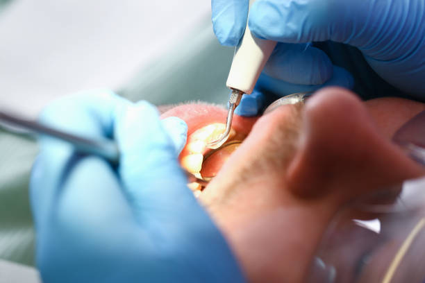 Best Emergency Gum Treatment in Westminster, MD